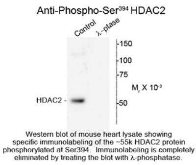 Western Blot: Histone Deacetylase 2/HDAC2 [p Ser394] Antibody [NBP2-29519]